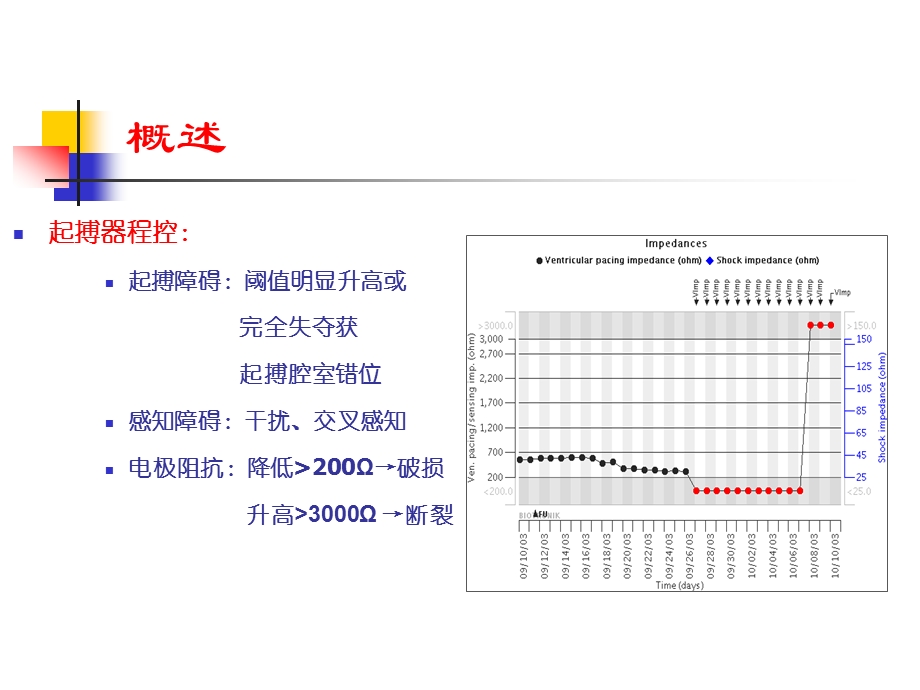 电极断裂的心电图警示.ppt_第3页