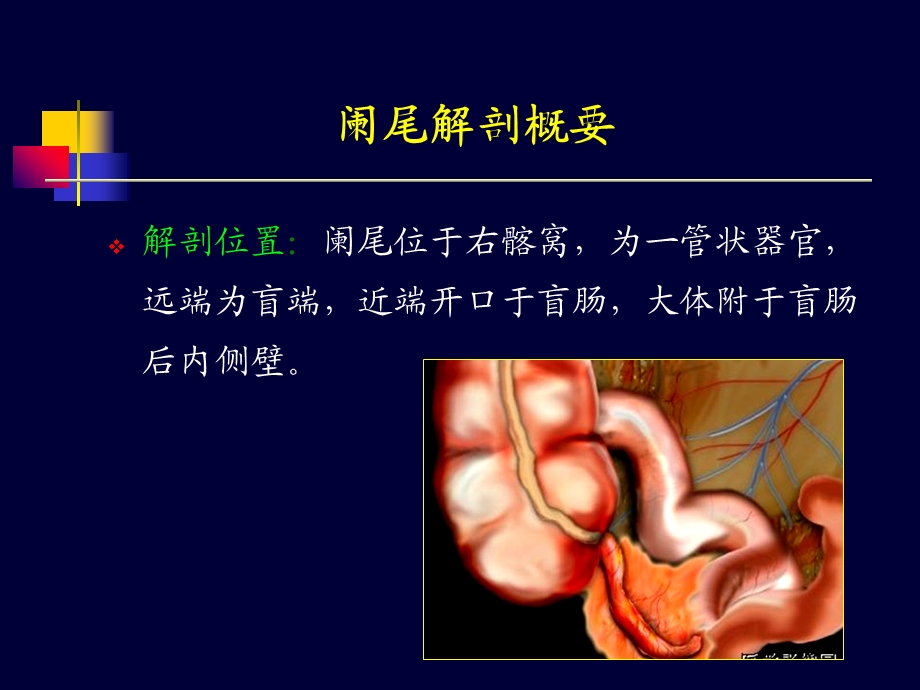 阑尾炎超声诊断.ppt_第3页