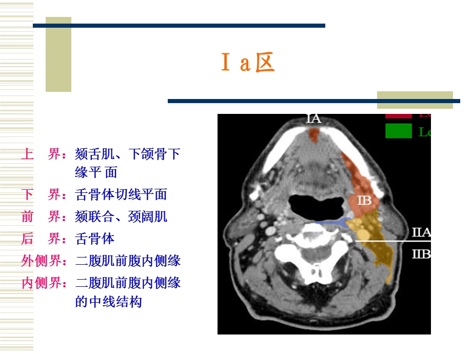 鼻咽癌淋巴引流区定界.ppt_第3页