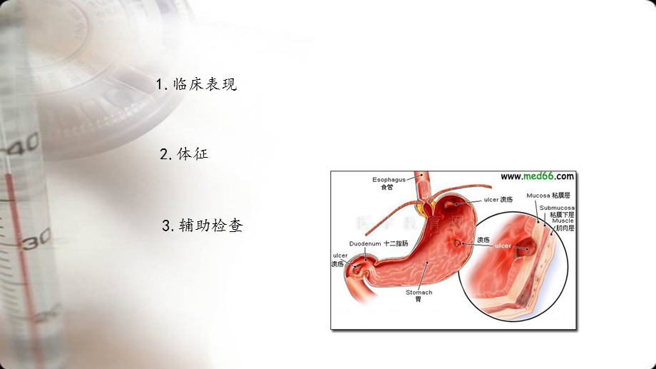 消化性溃疡的诊断与鉴别诊断.ppt_第3页