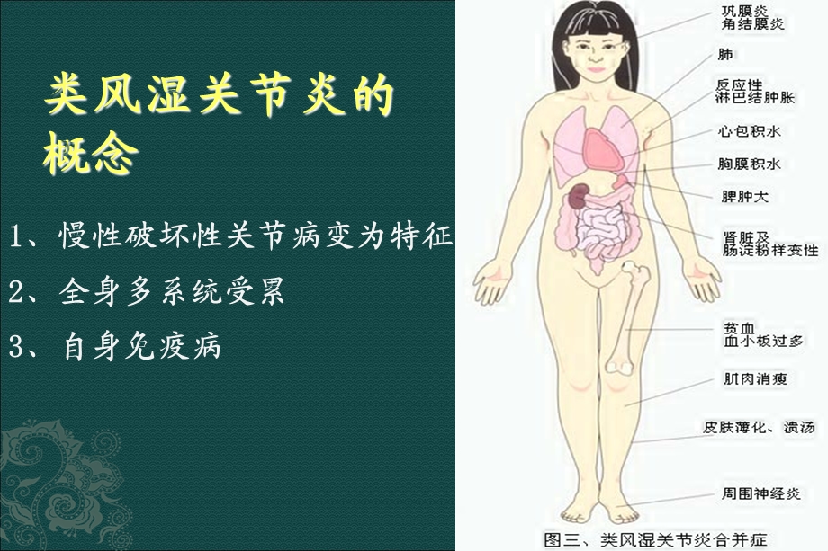 生物制剂的临床应用-杨旭燕.ppt_第3页