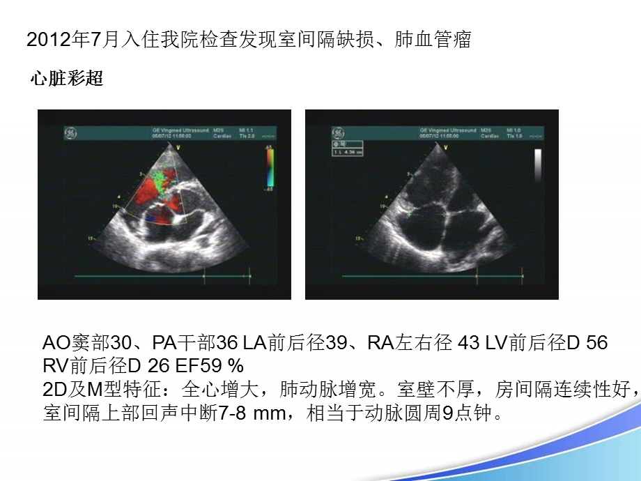 广西人民医院心内科伍广伟.ppt_第3页