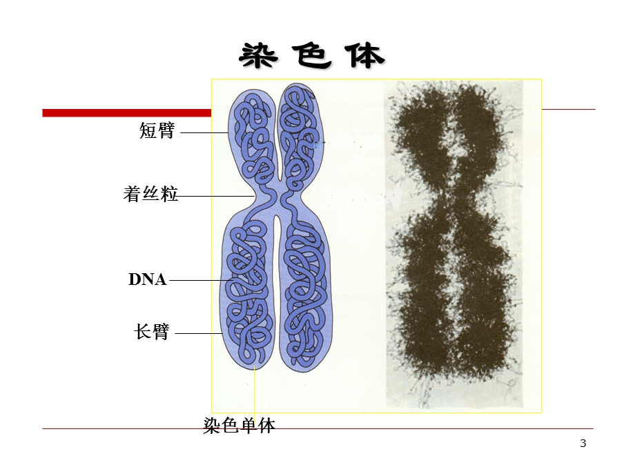 遗传物质的改变染色体畸变.ppt_第3页