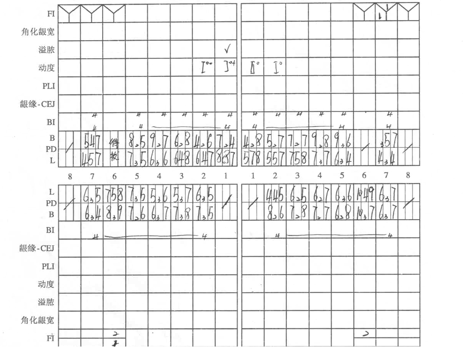 牙周基础治疗的临床病例介绍2.ppt_第3页