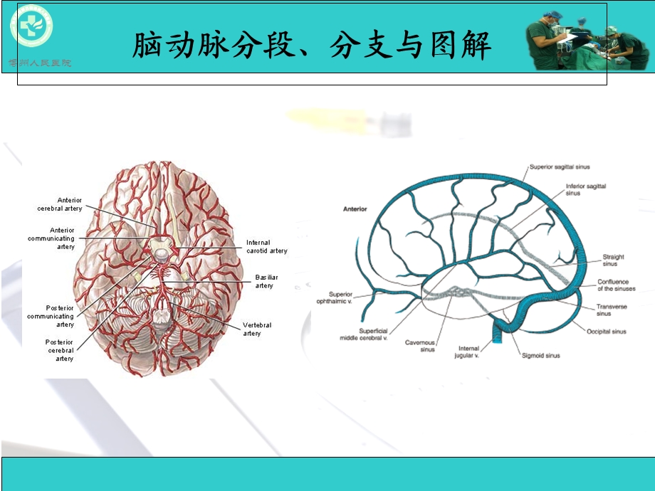 脑动脉解剖与CT重建D.ppt_第2页