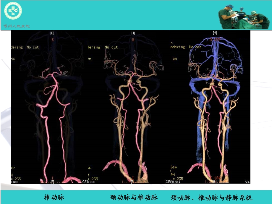脑动脉解剖与CT重建D.ppt_第3页