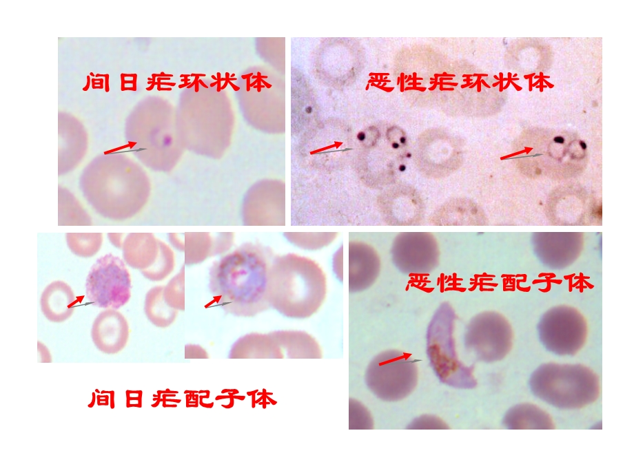 各期疟原虫形态ppt课件.ppt_第2页