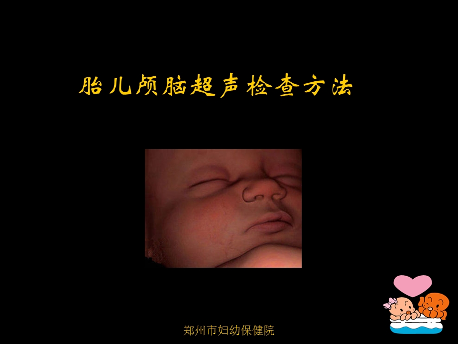 胎儿中枢神经系统的超声检查.ppt_第3页