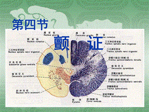 第四节颤证.ppt