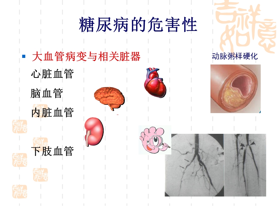 糖尿病综合围手术.ppt_第2页