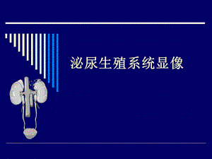 泌尿生殖系统显像.ppt