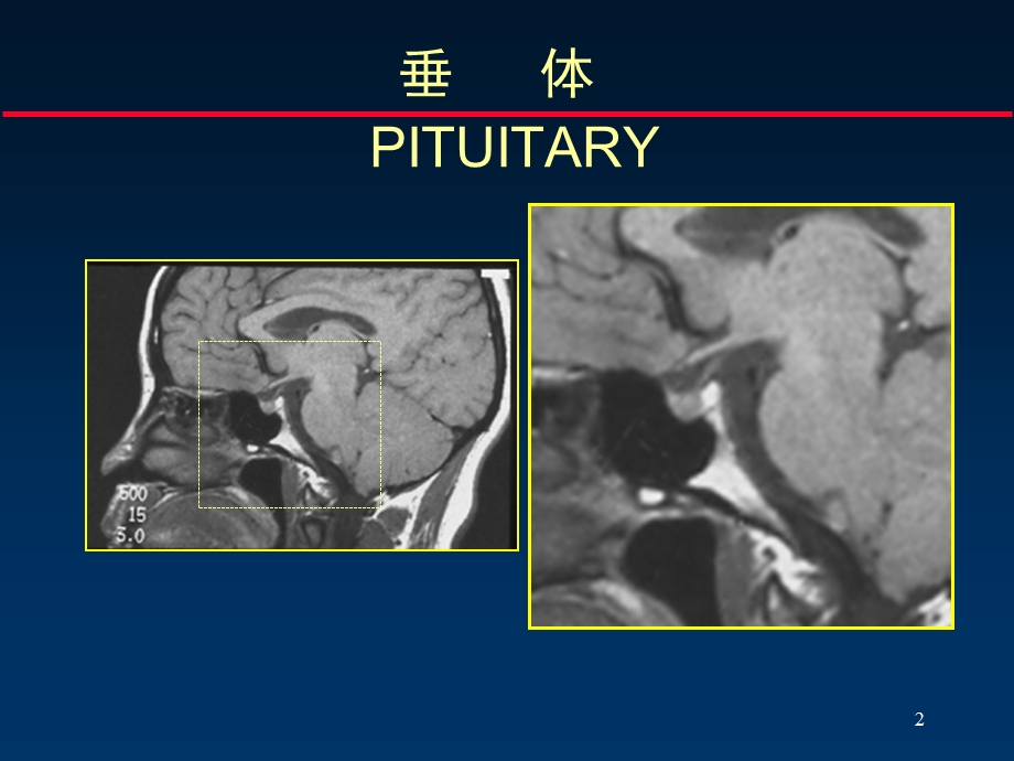 鞍区病变断解10.ppt_第2页