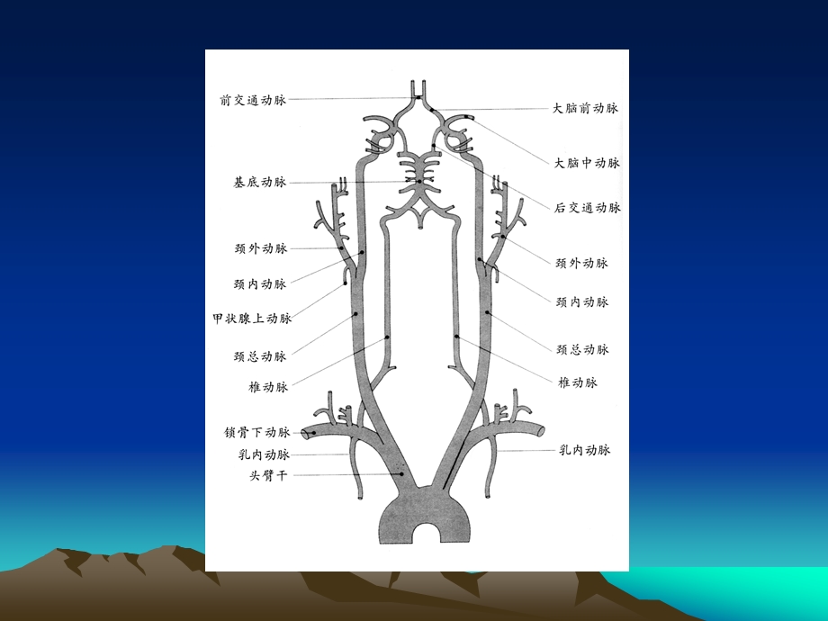 锁骨下动脉窃血.ppt_第3页