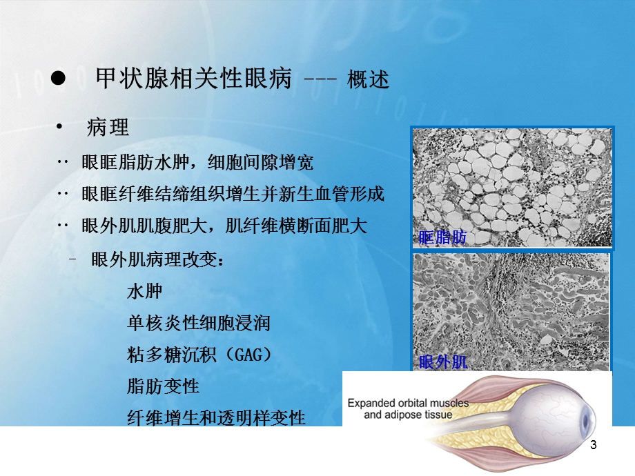 甲状腺相关性眼病影像学表现.ppt_第3页