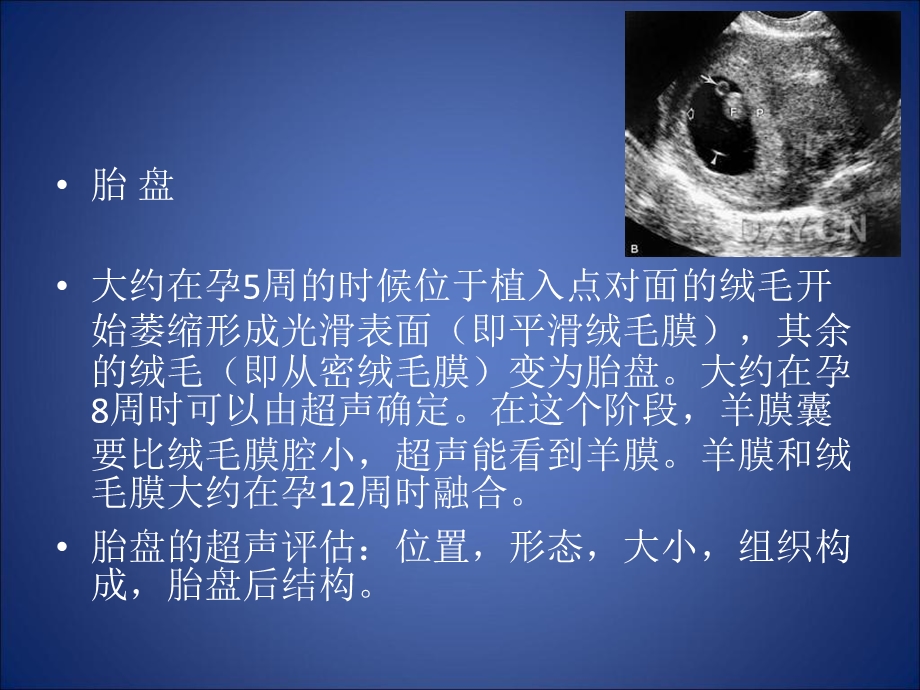 胎盘与脐带异常.ppt_第2页