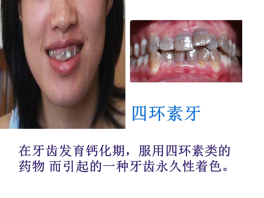 用药和急救shangke修改稿.ppt_第3页