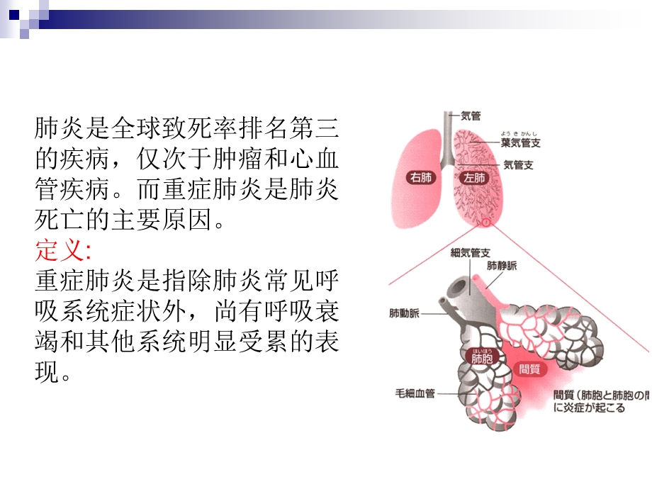 重症肺炎的护理.ppt_第2页