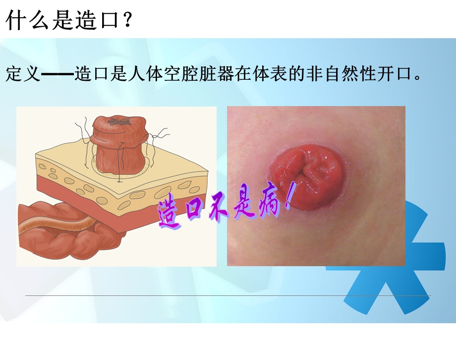 结肠造口术后注意事项2(高旭).ppt_第3页