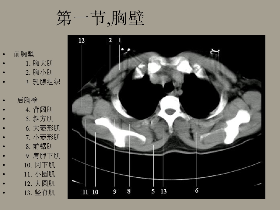 胸部正常CT表现.ppt_第2页