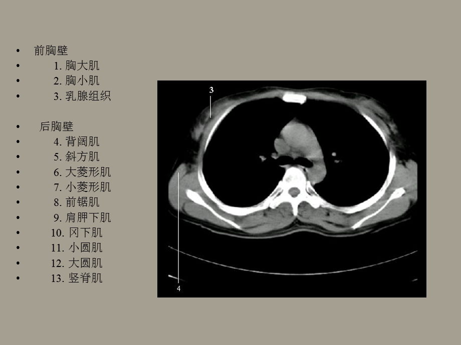 胸部正常CT表现.ppt_第3页