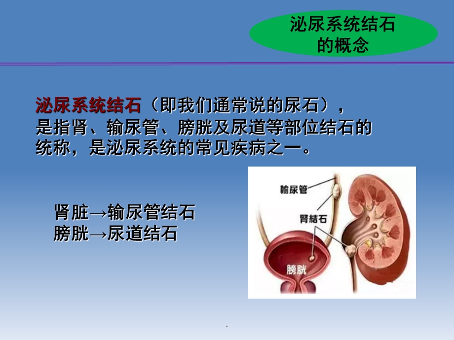 泌尿系统结石的防治PPT课件.ppt_第3页