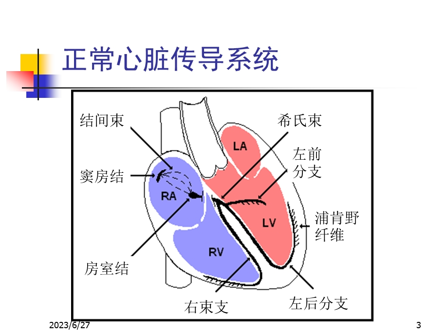 危北京大学人民医院 急诊重症心律失常处理.ppt_第3页