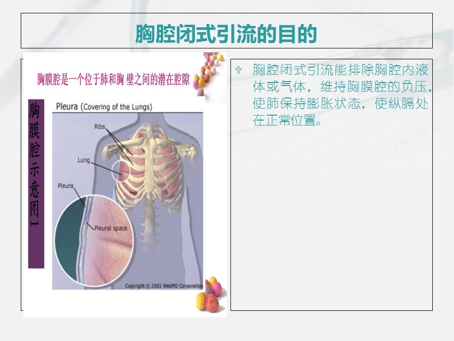 胸腔闭式引流的护理及注意事项.ppt_第3页