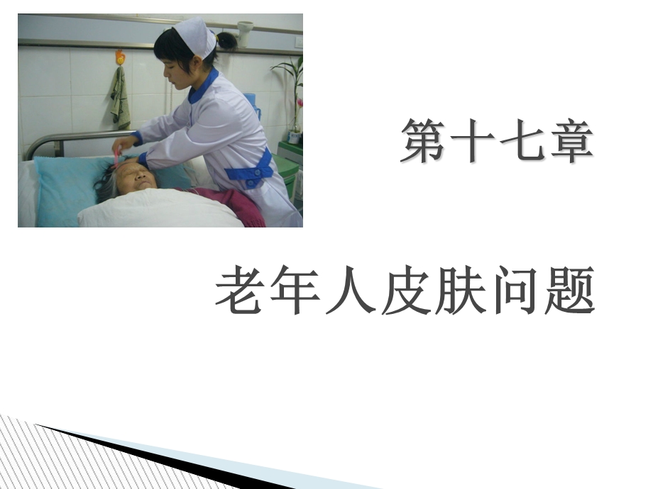 老年人皮肤问题.ppt_第1页