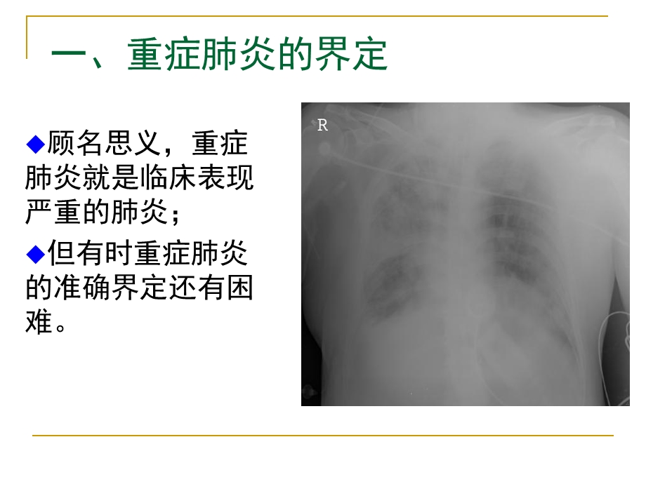 重症肺炎的诊治张伟.ppt_第3页