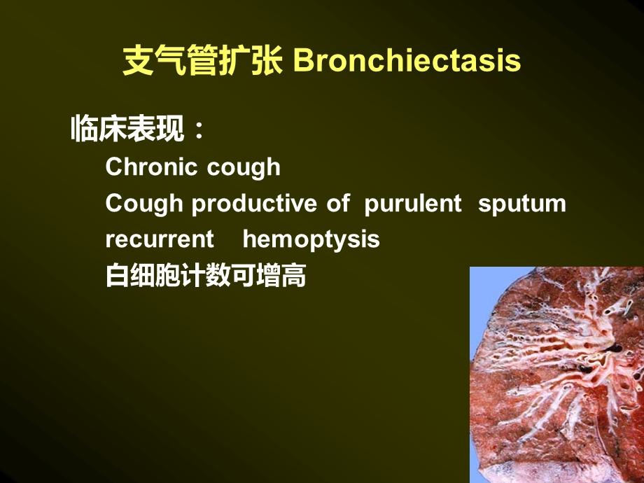 5年制呼吸各论1.ppt_第3页