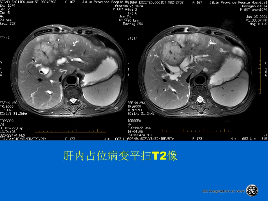 腹部扫描脉冲序列.ppt_第2页