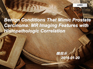 前列腺癌的MR特征.ppt