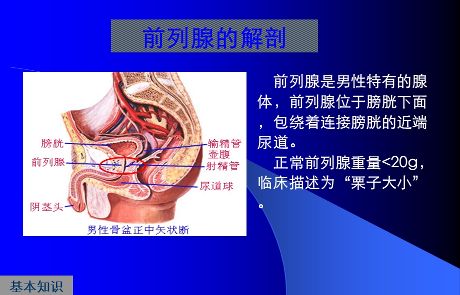 前列腺炎症及增生症.ppt_第3页