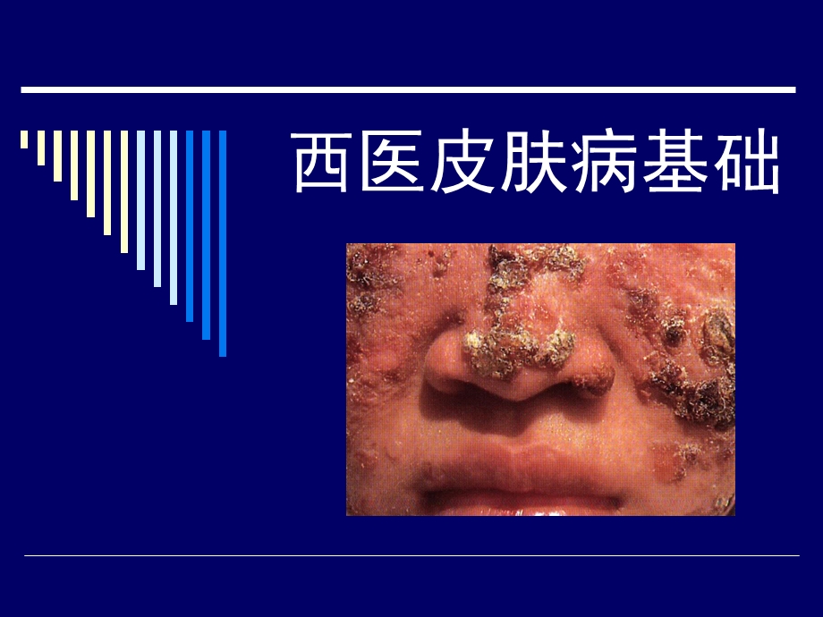 皮肤病西医基础.ppt_第1页