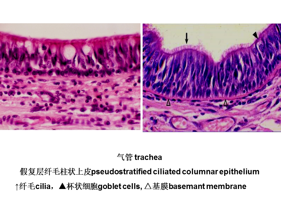 组织学与胚胎学图片考试.ppt_第3页