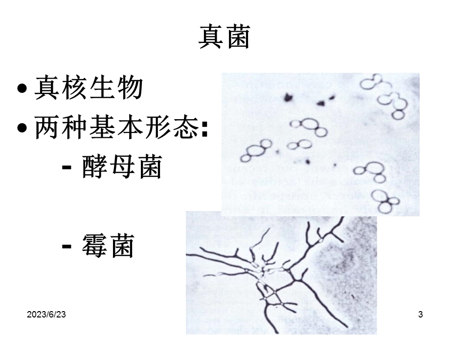 真菌的分类与致病性.ppt_第3页