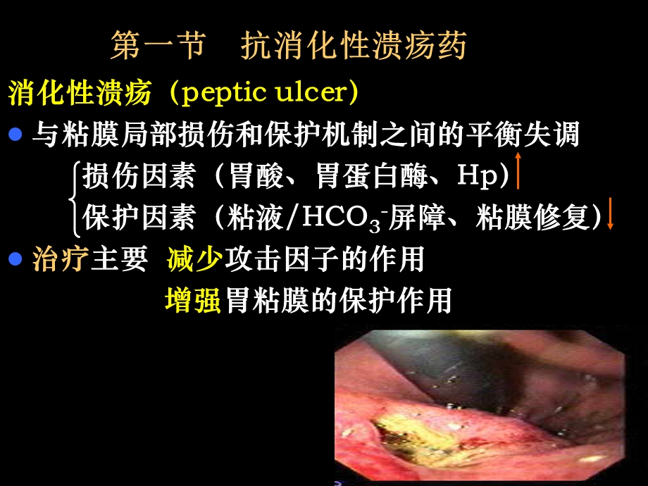 药理学作用于消化系统的药物课件.ppt_第3页