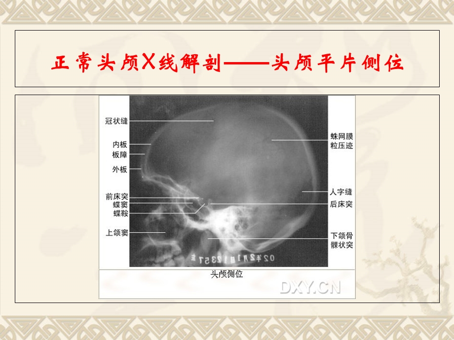 正常头颅X线解剖-头颅平片后前位.ppt_第2页