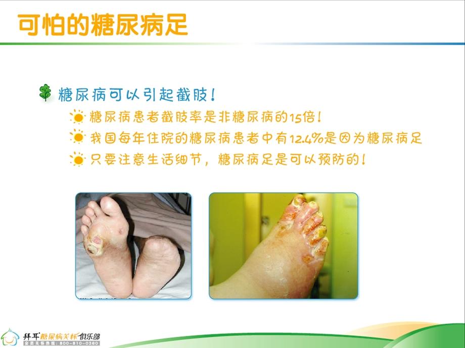 糖尿病家庭护理.ppt_第3页