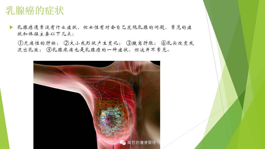 科学认识乳腺癌.ppt_第3页