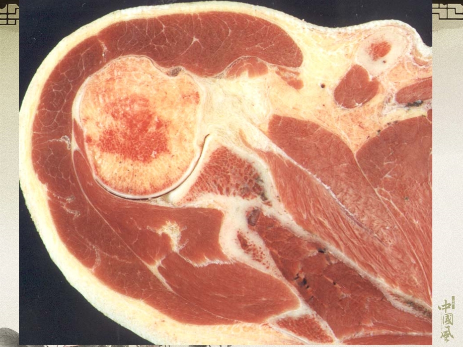 14四肢断层解剖及CT、MRI.ppt_第3页