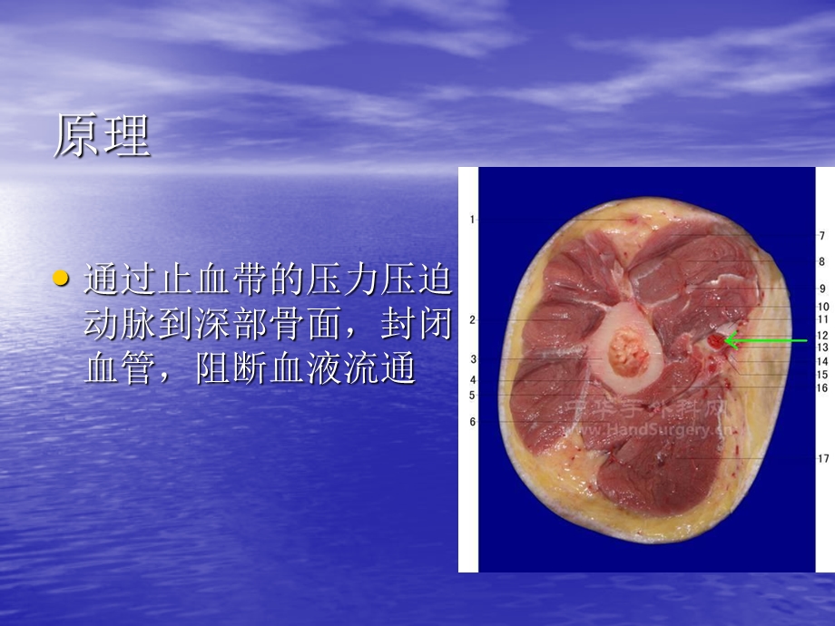 止血带使用方法.ppt_第3页