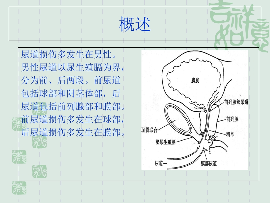 尿道损伤的治疗与护理.ppt_第2页