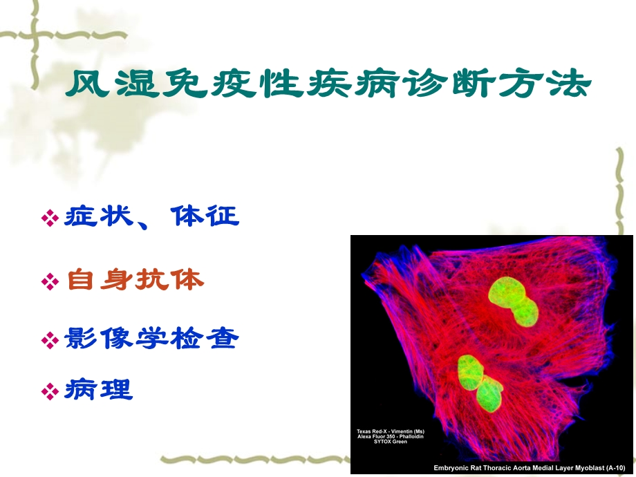 抗核抗体检测及临床意义-张瑾.ppt_第2页