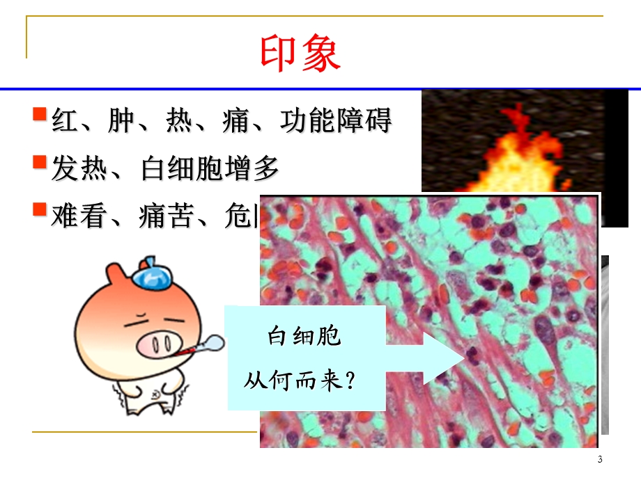 4炎症临床等.ppt_第3页