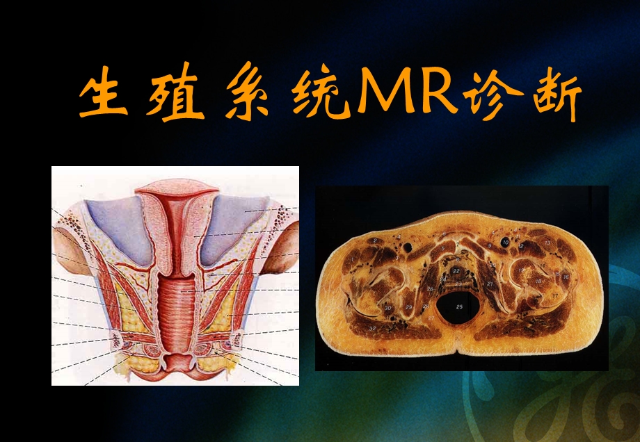 生殖系统MRI诊断.ppt_第1页
