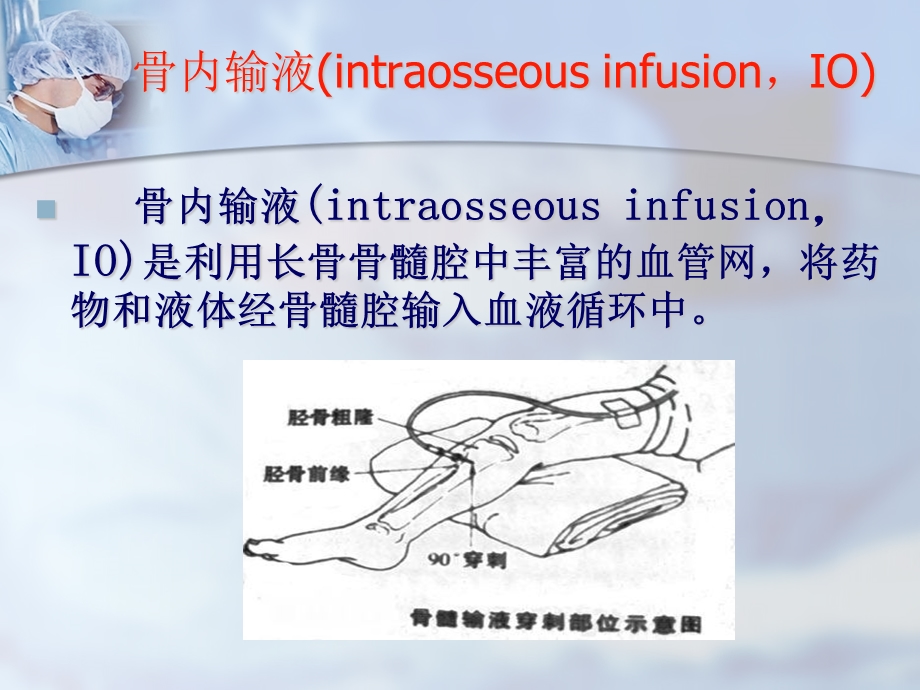 骨髓输液在急诊医学中的应用研究 ppt课件.ppt_第2页