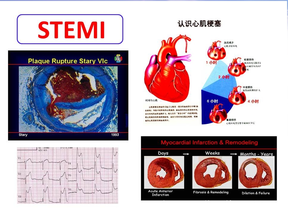 胸痛中心的时钟统一及时间管理.ppt_第3页