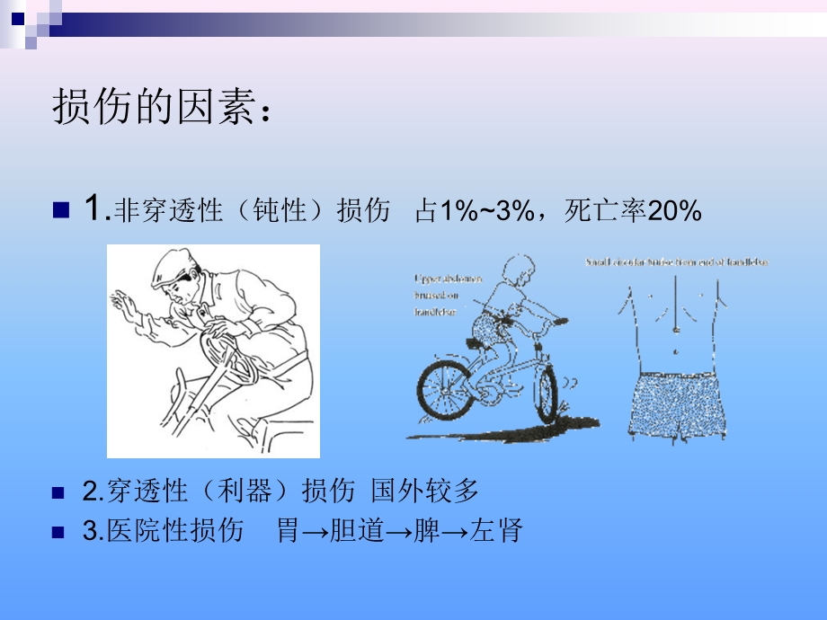 胰腺手术术后胰瘘.ppt_第2页