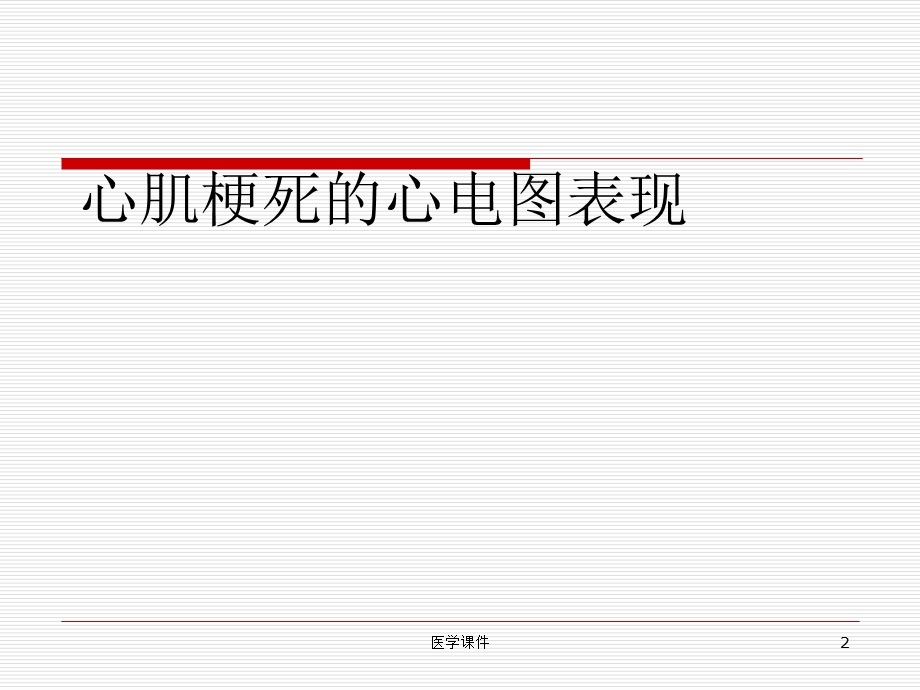 心肌梗死的心电图表现.ppt_第2页